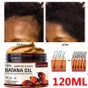 Natural BATANA OIL Hair Growth Serum- Fast Hair Regrowth Hair