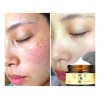 Crema Blanqueadora Despigmentante Reduce Melanina