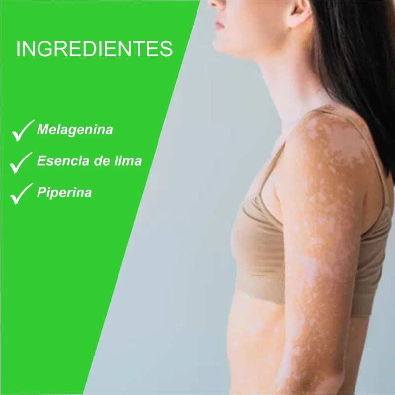Crema Y Jabón Para Vitíligo Inicial