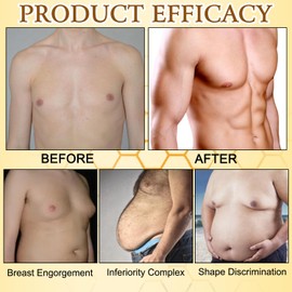 YOUSHEME ThermoFirm Bee Venom Gynecomastia Oil, Chest Muscles Bee Venom Oil, Bee Venom Gynecomastia oil for Strengthen the Chest Muscles (2PCS)