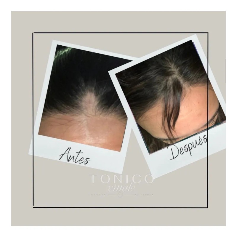 Tónico Vittale Anticaída Crecimiento Restaura Cabello Paso 1