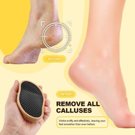 SG Nekoo Foot File Callus Remover for Feet, Pedicure Foot Scrubber with Nano Glass to Remove Hard Dead Skin, Foot Care Scraper for Wet and Dry Feet (Black)