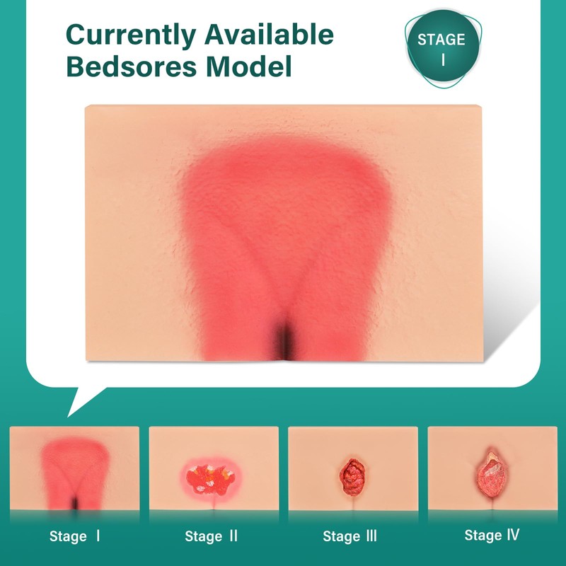 MedEduQuest Decubitus Ulcer Wound Care Model, Bedsores Model, Pressure Injury