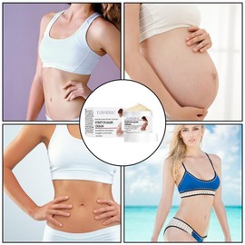 ZONEWD Stretch Mark Remover Cream,Repair Skin Stretch Mark Remover - Multi-Purpose Skin Care Supplies for Buttocks, Abdomen, Breasts, and Thighs