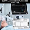 2PCS ECG Ruler 7 Step - Plastic ECG Card -