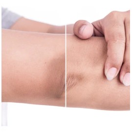 Stanhome Skin Glo Crema Exfoliante 300 Ml