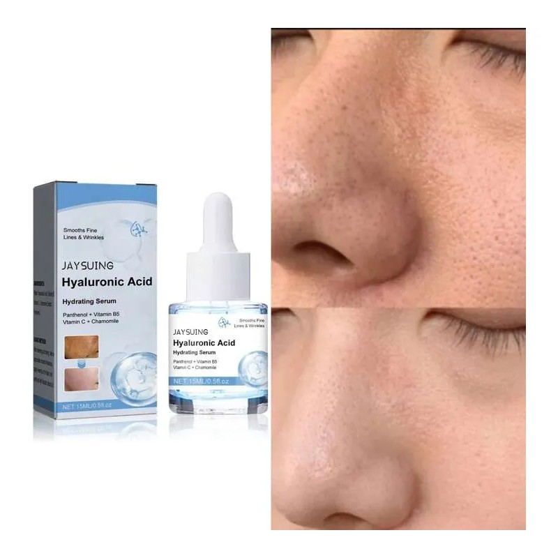 Jay Serum Hidratante Acido Hyaluronico Aclarante De Piel