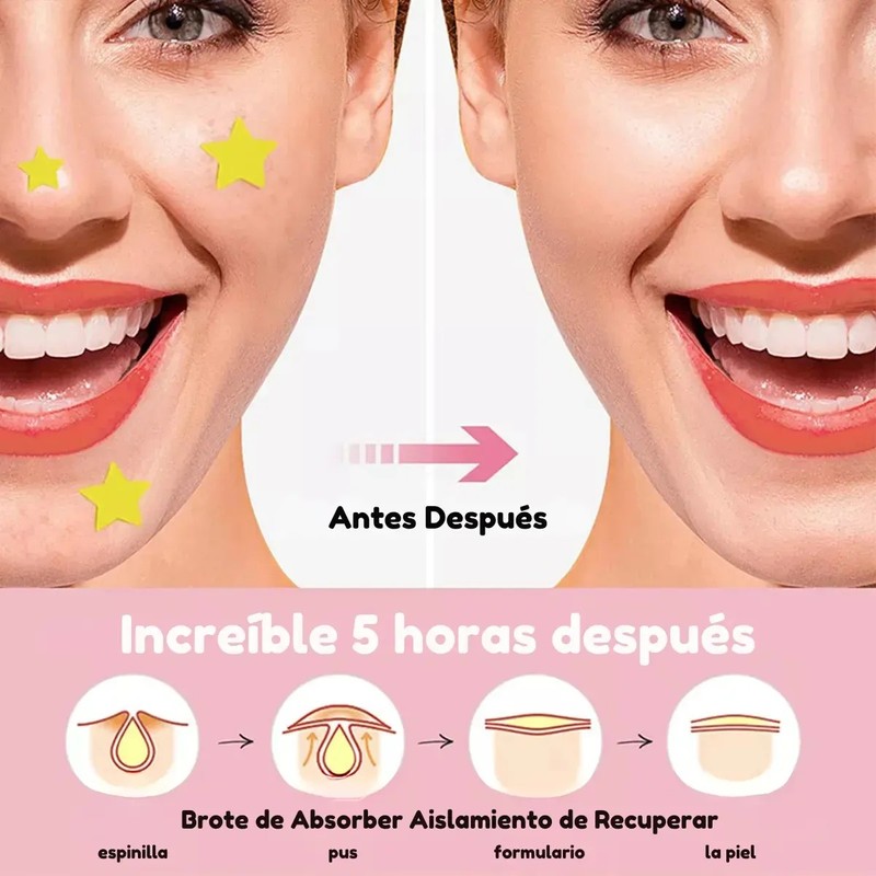 720pz Parches Cuidado Facial Elimina Acné Espinillas Figuras Todo Tipo