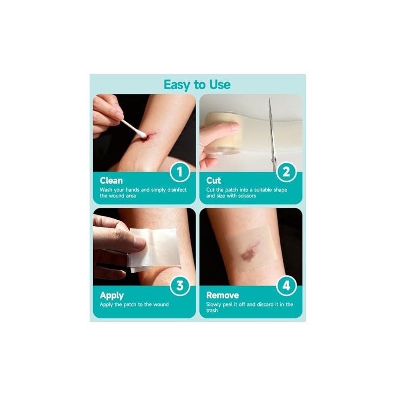 Hydrocolloid Roll 5CM*3M, Hydrocolloid Bandages Roll, Para el Cuidado de