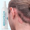 BRIOTECH BRIOTECH Topical Skin Spray, Hypochlorous Acid Spray for Body