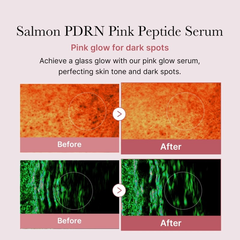 Medicube PDRN Pink Peptide Serum 30ml | Dark Spots |