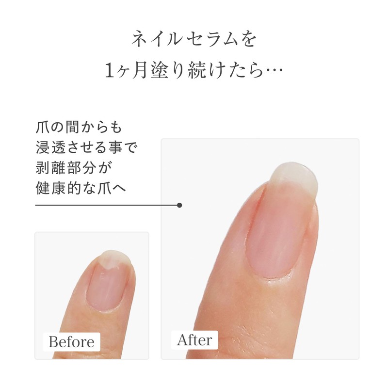 uka Better Nail Serum, 0.3 fl oz (10 ml) Nail