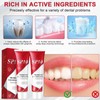 SP10 Probiotic Toothpaste, 2Pcs 100g Teeth Whitening Toothpaste with 4