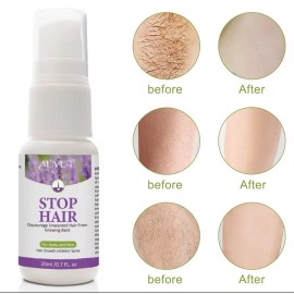 Aromixe Stop Hair – Hair Growth Inhibitor Spray for Face & Body – 20ml / 0.7 fl. oz