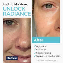 Ember Cloud Hyaluronic Acid Serum for Face (2 Oz) for Skin and Lips - Hydrating & Moisturizing Serum for All Skin Types, Paraben-Free & Fragrance-Free