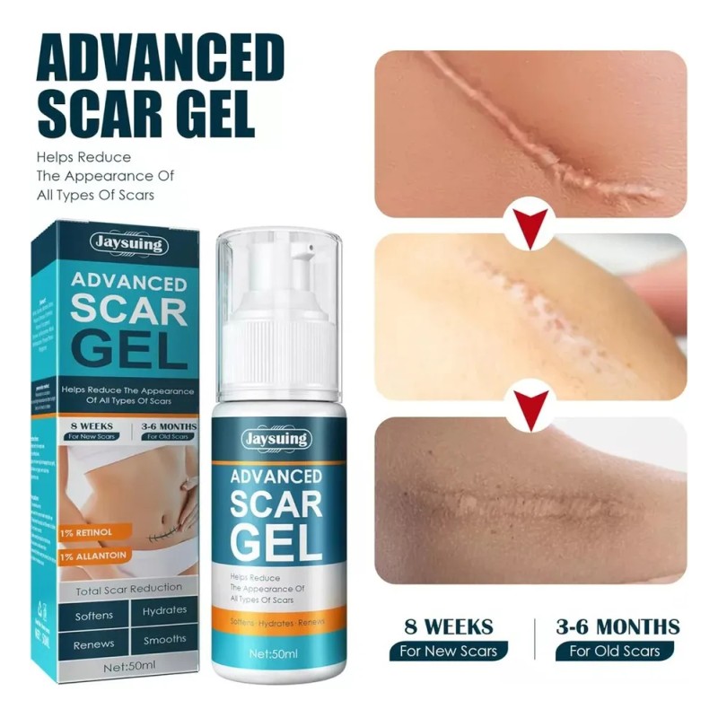Crema Gel Reparadora Cicatrices Acné Jaysuing 50 Ml Estrías