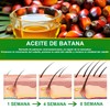 BSMKD 2 PCS Aceite de Batana, 120ML aceite de Batana
