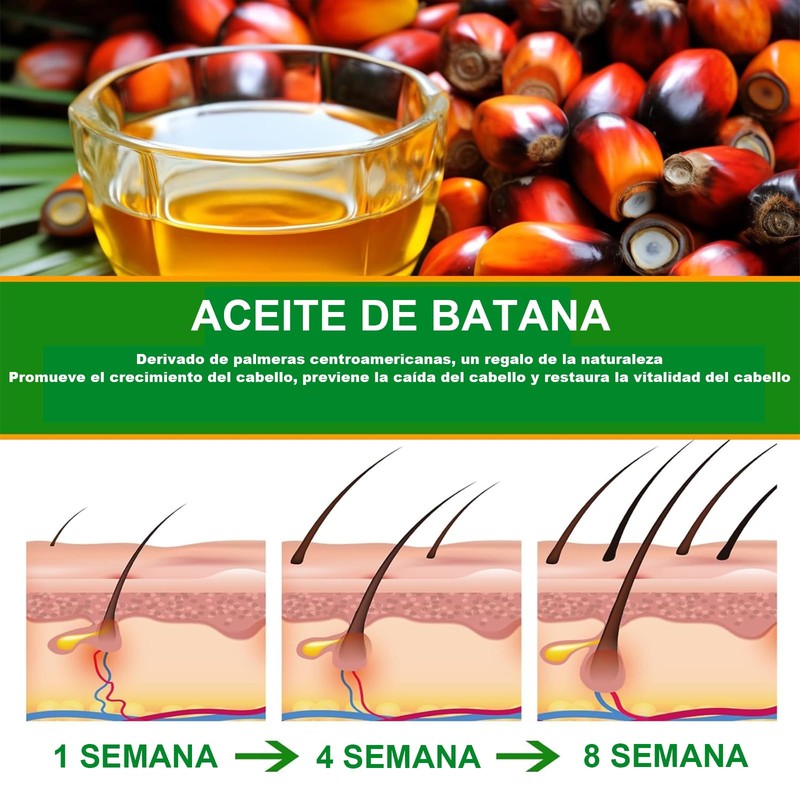 BSMKD 2 PCS Aceite de Batana, 120ML aceite de Batana