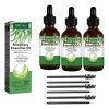 3pcs Romero Aceite Romero Para Cabello El Cuero Cabelludo