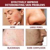 Solución Peeling Facial AHA BHA - Sérum Exfoliante Facial con