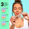 Spot Patches by Patch Perfect® (102 Pack) - Ultra-Thin Acne