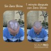 Zero Shine Spf Elimina El Brillo Y Protege Tu Cabeza
