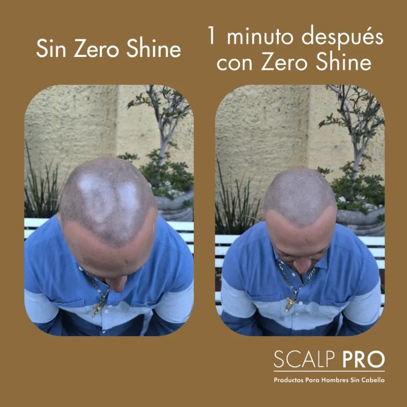 Zero Shine Spf Elimina El Brillo Y Protege Tu Cabeza