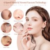 Blackhead Remover Black Head Remover for Face Whitehead Acne Remover