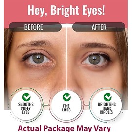 Eye Mask for Puffiness - Under Eye Patches for Dark Circles - Korean Under Eye Mask Patches for Puffy Eyes - Eye Gel Pads Depuffing Eye Brightener with Rose, Caffeine, Hydrogel & Collagen (10 Pairs)