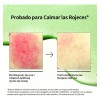 Kit Serums Niacinamida + Txa Y Ácido Azelaico Anti-manchas