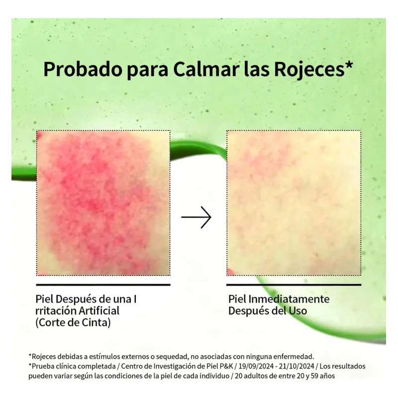 Kit Serums Niacinamida + Txa Y Ácido Azelaico Anti-manchas