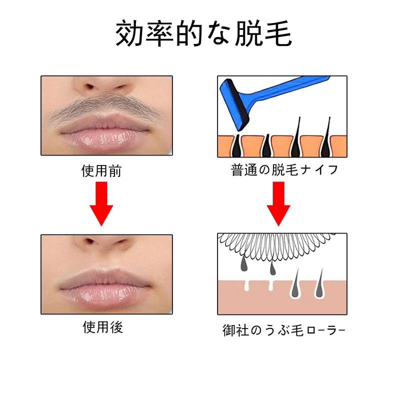 BRIIKPP Pore Roller, Epi Roller, Pore Remover Coil, Slow Rotation,