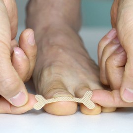 Linku RX Care Band Ingrown Toenail Tape, 50 sheets, Correction of Ingrown Toenails / 링쿠 RX케어밴드 내성 발톱 테이프 50매입 교정 파고드는발톱