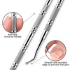 Ingrown Toenail Tool Kit: Ingrown Toenail Clippers, Ingrown Toenail File