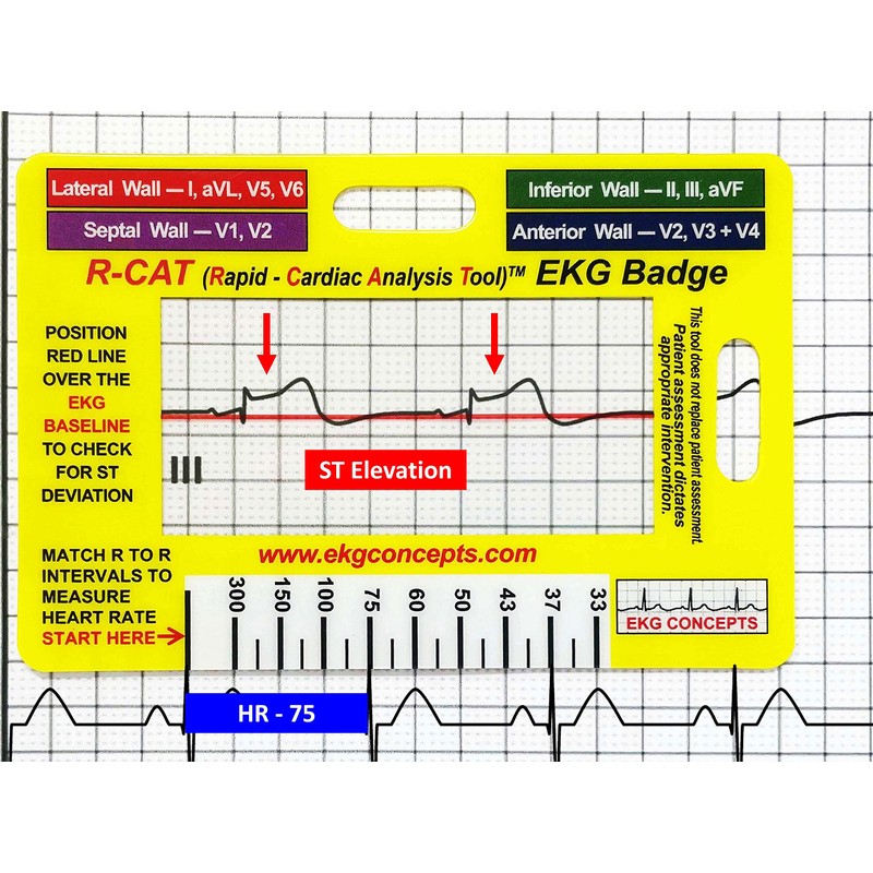 R-CAT EKG Badge