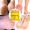 2pzs Exfoliante Para Pies Suaviza Resequedad Elimina Callo F