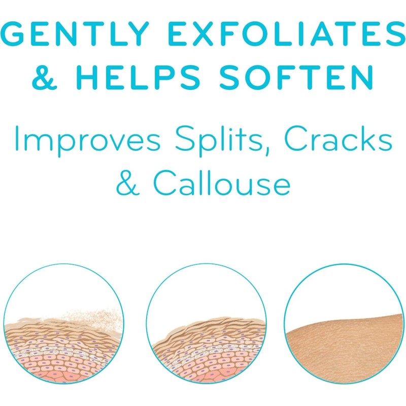 AmLactin Foot Repair Cream 15% Lactic Acid 3oz for Dry