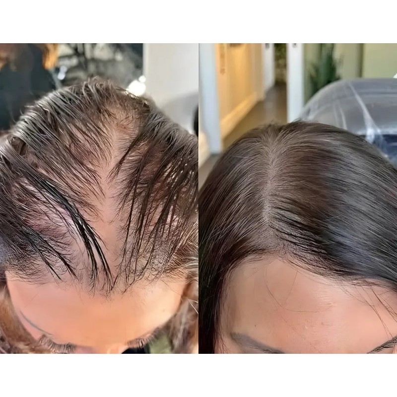 Shampoo Reviving Farmasi Caida Cabello
