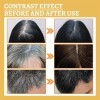 Suero Tratamiento De Las Canas, Unisex, Color Natural