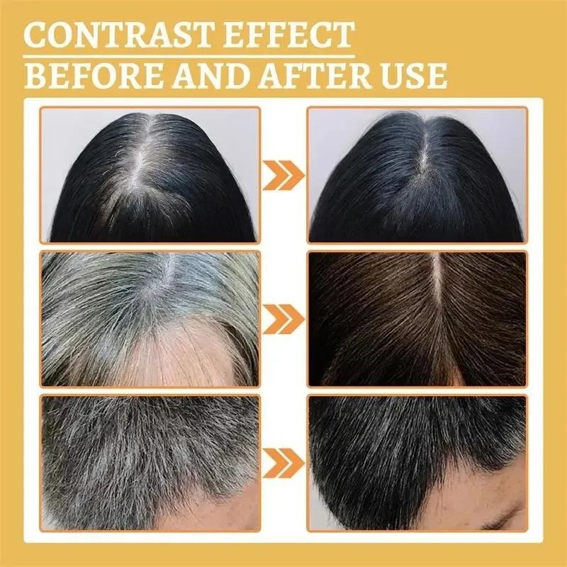 Suero Tratamiento De Las Canas, Unisex, Color Natural