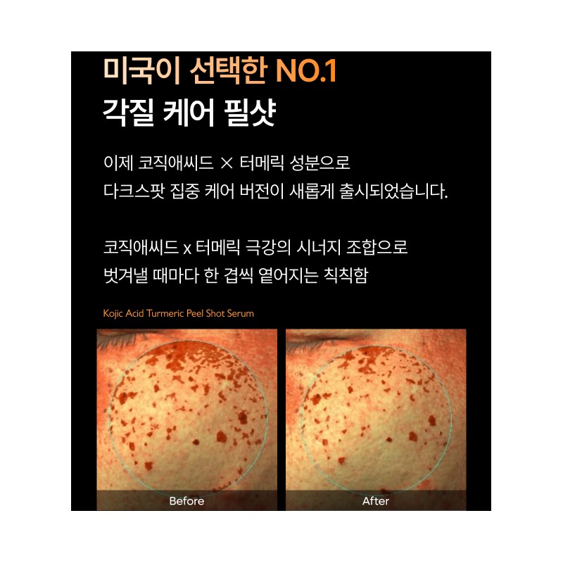 닥터 멜락신 필샷 얼굴 각질 제거 피지 연화제 코직애씨드 터메릭