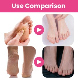 Foot Je/lly Bath Salt,J/elly Pedicure Packs Rose F/oot B/ath Salts,P/edicure Jel/ly Spa Fo/ot Soak,Cry/stal Jell/y S/pa Foo/t S/oak,Jel/ly Pe/dicure Packs,Pedicure Je/lly Spa Foot So/ak(Rose)