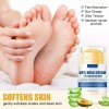 crema For Pies Con 60 % De Urea Y 2