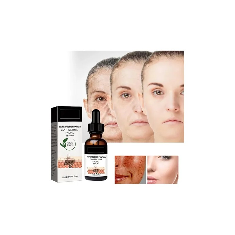 Melanin Correcting Facial M Oloration Effective Correcting