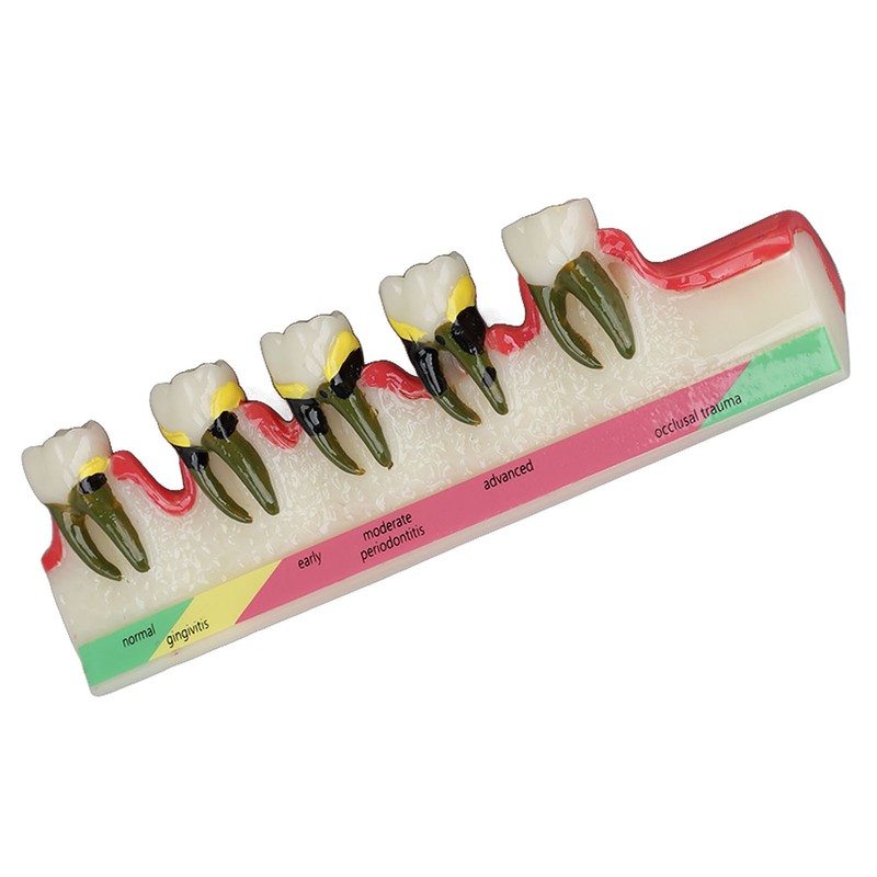Dental Teeth Model Ceramic Clear Structure Oral Care Educational Periodontal