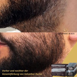 Salvathor Duran 5 Single Doses (25 ml per dose, Total 125 ml) for Removing Grey Hair Dye in Black for Beard and Hair