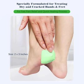 Parche de gel de aloe vera natural de 50 unidades para pies, talones y manos agrietados secos. Parche de hidratación de algodón para alivio rápido del