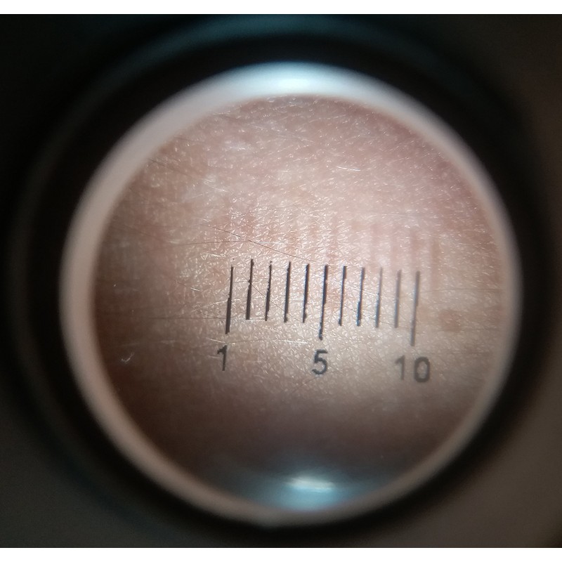 Cross Canada 11-050 LED Dermatoscope Diagnostic Set