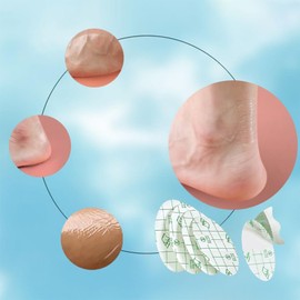 Zealburst Self Adhesive Invisible Heel Anti-Wear Sticke, Zealburstj Heel Protector Sticker, Waterproof Anti-Wear Foot Care Protection Pad, Heel Protector Sticker (100PCS, Small)