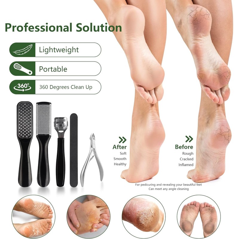 Professional Manicure and Pedicure Tool Kit Exfoliation Foot File Set: